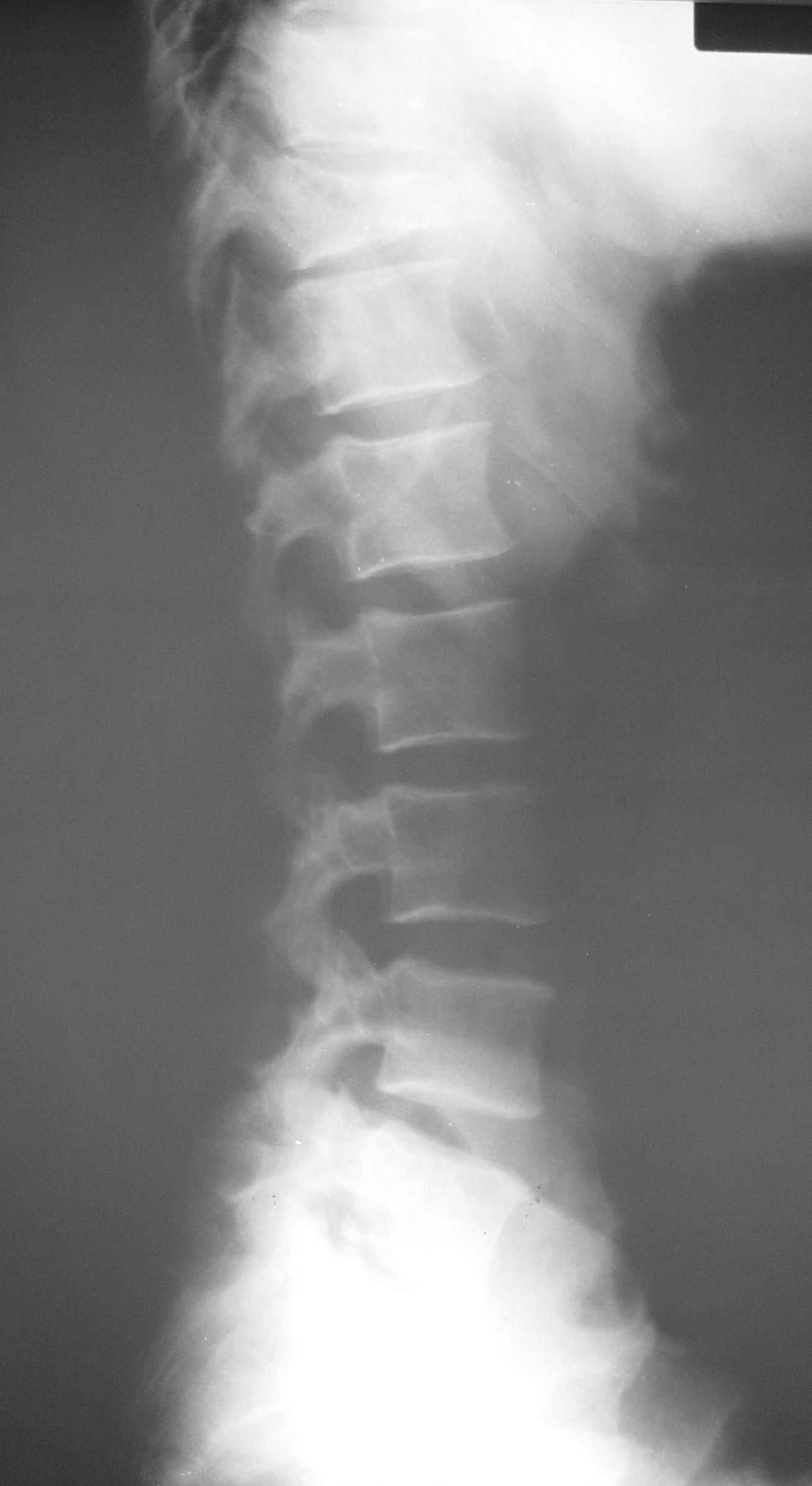 UCSD Musculoskeletal Radiology